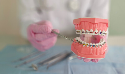 In a dental clinic, an orthodontist holds a model of teeth with braces while demonstrating dental...