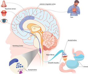 Mechanisms of Nausea and Vomiting resulted from the repulsive senses. Brain illustration with vomiting zones and senses