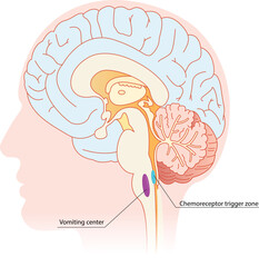 Vomiting center and chemoreceptors trigger zone anatomy. Schematic illustration of a brain with topography of CTZ and VC zones