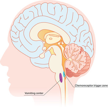 Vomiting center and chemoreceptors trigger zone anatomy. Schematic illustration of a brain with topography of CTZ and VC zones