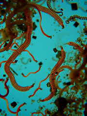 photo of human parasite worms under the microscope