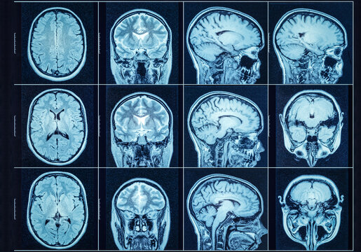 Closeup of a CT scan with brain. Medical, science and education mri background. Magnetic resonance imaging