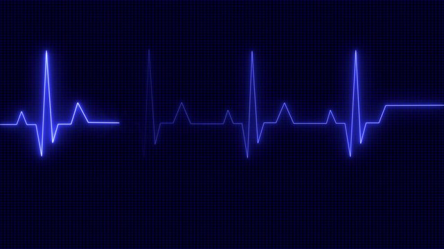 Abstract neon heartbeat signal icon animation background. This is an electrical activity of heart. This can present various types of diseases of heart. This is used as initial investigation of heart.