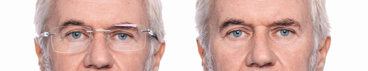 Two close-up views of a man's face showing the difference between wearing and not wearing...