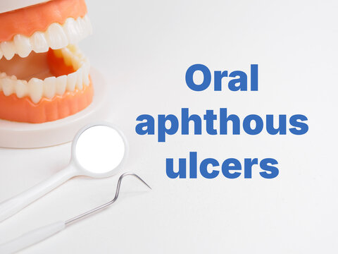 "Oral aphthous ulcers" inscription title on dental background