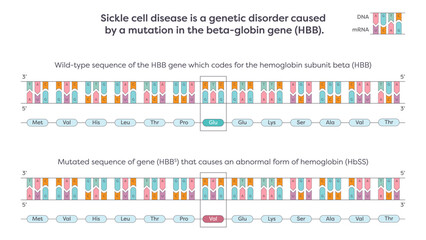 Sickle cell SNP mutation in the beta-globin HBB gene graphic illustration