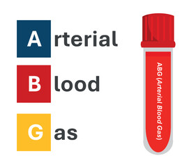 Taking arterial blood gases and placing them in a glass tube for laboratory testing. Arterial blood gas (ABG) test measures the oxygen and carbon dioxide levels in blood as well blood's pH balance. 