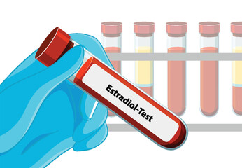 Medical Blood Test Illustration