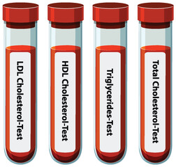 Cholesterol Blood Test Tubes Illustration
