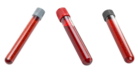 set of blood test tubes isolated on white background