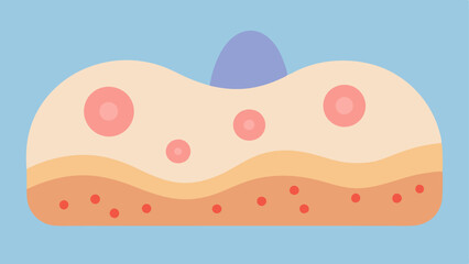 Wound Healing A skin surface illustration with acne scars represented as small uneven areas. Exosomes are shown enveloping the scars indicating their role in the healing process.