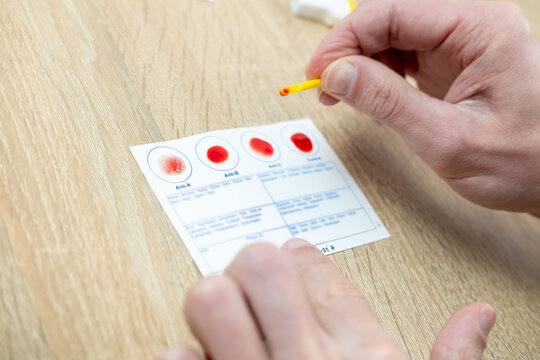 Blood Typing Images – Browse 44,814 Stock Photos, Vectors, and Video ...