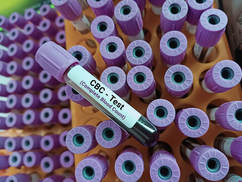Scientist holds Blood samples for Complete Blood Count (CBC). Blood test for Complete Blood Count Test in the laboratory background.