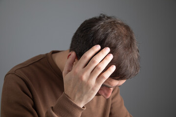 Fototapeta premium Caucasian man after eleven month hair transplantation.