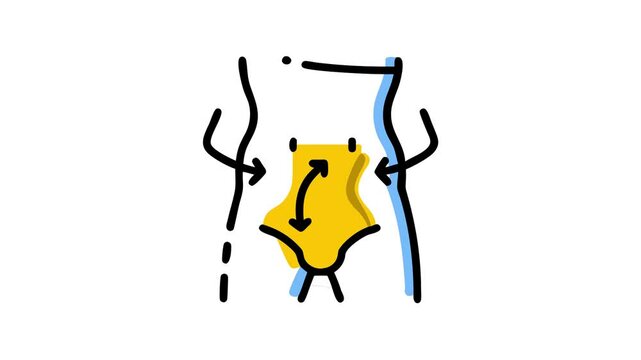  hernia inguinal disease 2d icon animation