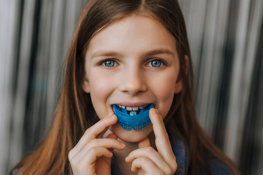 Close-up photo, portrait of beautiful happy smiling child girl face with blue silicone denture, mouth guard for alignment, teeth treatment in dentistry.