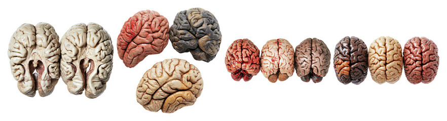 Realistic Human Brain Models for Educational and Medical Use, PNG bundle collection, Isolated on Transparent Background