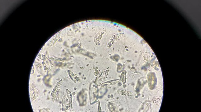 Epithelial cells present in urine sediment examine by microscope.