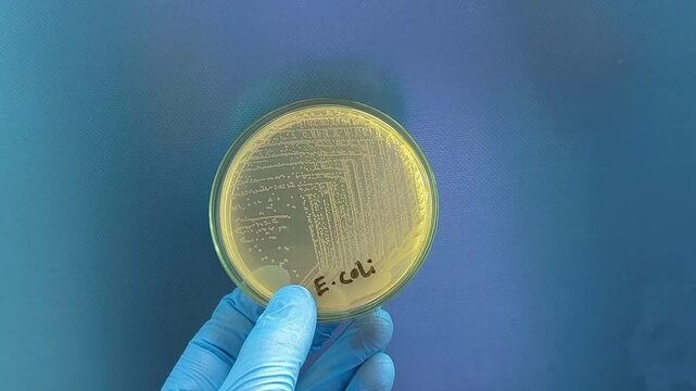 A microbiological culture Petri dish with a colonies of the pathogenic bacterium Escherichia coli (E. coli)