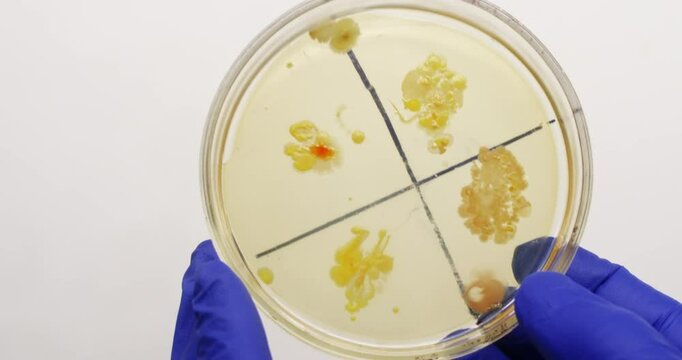 Petri dish divided into zones of bacterial colony growth. Large bacterial colonies on a nutrient medium.