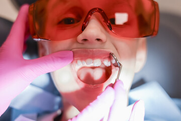 Dental treatment for a child using a medical dental drill and mirror. Dentist treats a childs...