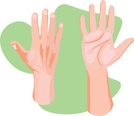 normal hand dorsal and palmar view 