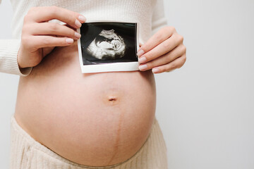 Pregnant woman holds an ultrasound photo of her baby on her tummy. Filming precious moments of motherhood with sonogram.
