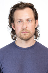 Fototapeta premium Adult male with Bell's Palsy or facial paralysis