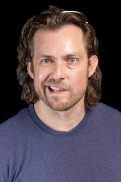 Adult male with Bell's Palsy or facial paralysis