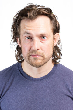 Adult male with Bell's Palsy or facial paralysis