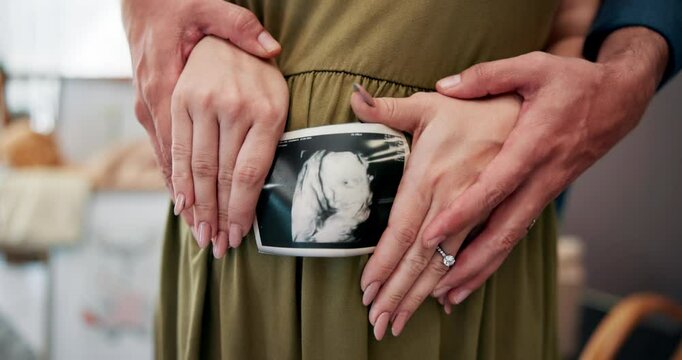 Hands, couple and stomach of pregnancy ultrasound, baby scan and maternity wellness. Pregnant woman, sonogram picture and partner support for growth development, family planning and prenatal at house