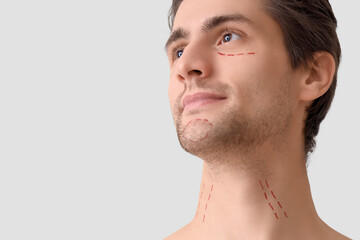 Obraz premium Young man with marked face on light background, closeup. Plastic surgery concept