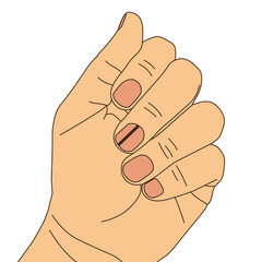 Melanoma black line in finger, illustration on white background