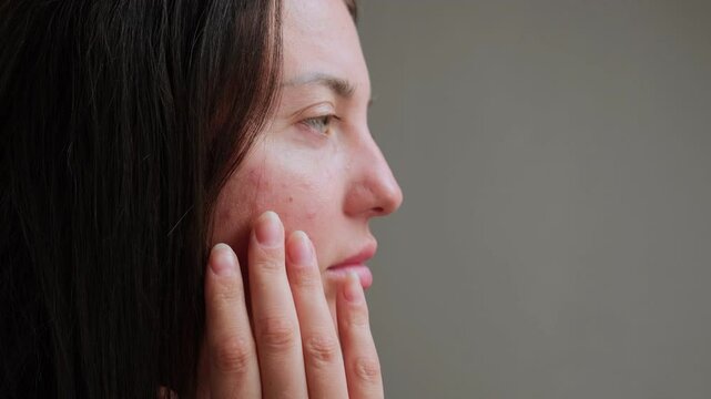 A young woman inspects her skin the next day after a biorevitalization procedure, noticing redness, hydration, and texture changes. Allergic red rashes. The concept of care for problem skin.