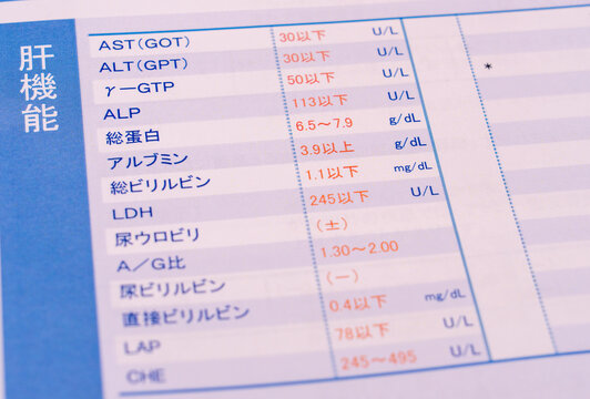 健康診断での結果判定と数値　血圧、メタボリック、血液、悪玉善玉コレステロール、ガンマGTPなど