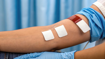 Obraz premium Medical procedure involving blood collection with bandages applied