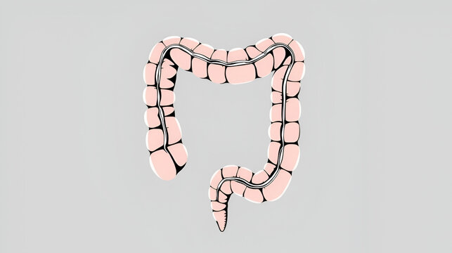 Colon. Proctitis. Vector illustration on a gray background
