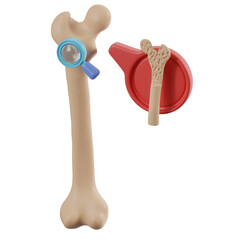 Review of osteoporosis in the bones. 3d illustration