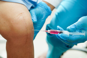 Asian doctor inject Hyaluronic acid platelet rich plasma into the knee of senior woman to walk...