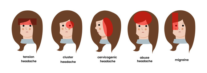 Cartoon headache types. Tension, temporal pain, cluster, allergy and occipital headache. Female character with migraine vector illustration set. Unhappy woman suffering from illness or discomfort.