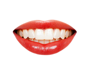 A close-up of a smiling mouth with glossy red lips and white teeth.