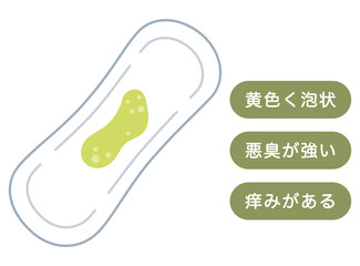 緑っぽい色のおりもの　女性の健康　ナプキン