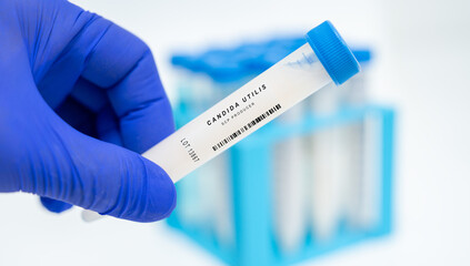 Candida utilis