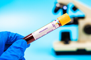 Nutritional marker Evaluates prealbumin levels, decreased in