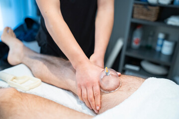 A therapist applies cupping therapy on a patient leg using pressure for muscle recovery