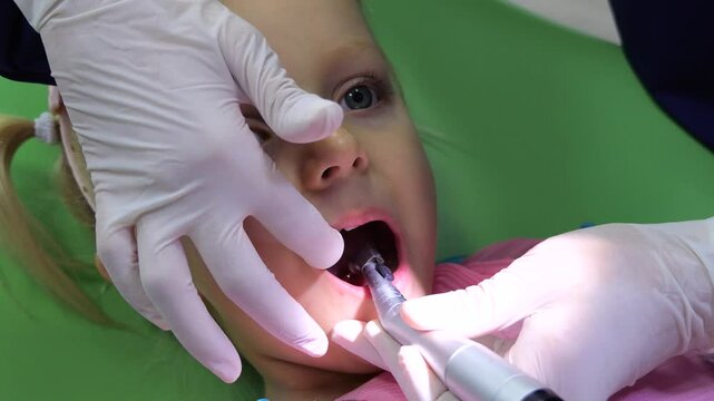 Professional pediatric dentist curing dental filling using specialized polymerization lamp while treating young patient's teeth in modern dental clinic