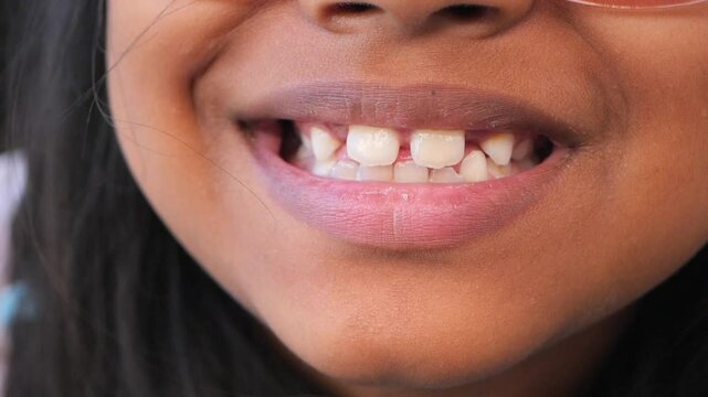 Smiling child showcases missing front teeth during summer fun