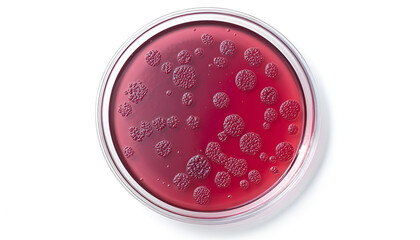 Petri dish with bacteria isolated on white, top view