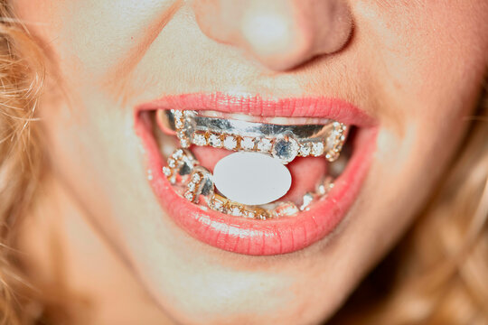 Close-up of a young woman's mouth with bright lipstick, wearing decorative dental grillz and biting on a pill. Vilnius, Lithuania