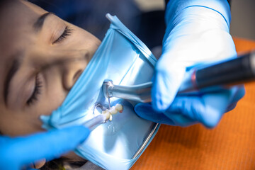 The dentist treats the child's tooth using a rubber dam. Close-up of tooth treatment.